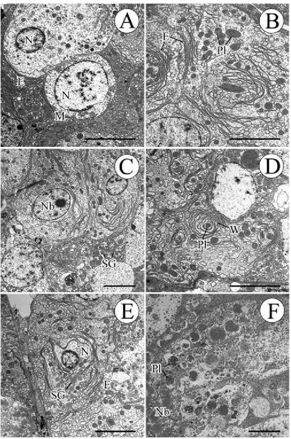 Fig 6. Transmission electron micrographs of the digestive gland of Oyster (Euihang-ri, August, 2008)
