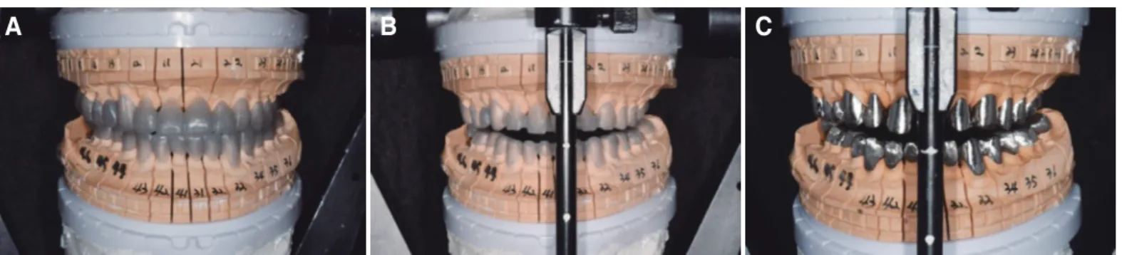 Fig. 9. (A) Full contour wax-up, (B) Cut back, (C) Metal coping fabrication.
