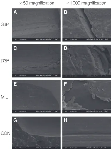 Fig. 5. SEM image of the worn surfaces of the resin materials after wear test  (S3P: SLA 3D printed resin; D3P: DLP 3D printed resin; MIL: milled resin; 