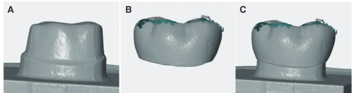 Fig. 3. Scanned three-dimensional surface data. (A) Titanium master die, (B) Monolithic zirconia crown, (C) Superimposed crown on the master die.