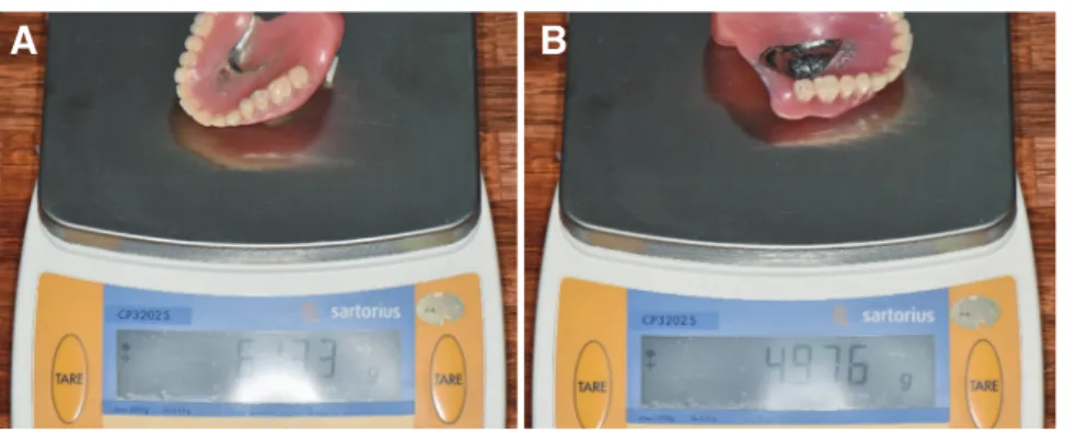 Fig. 11. Extraoral photograph with nasometer.
