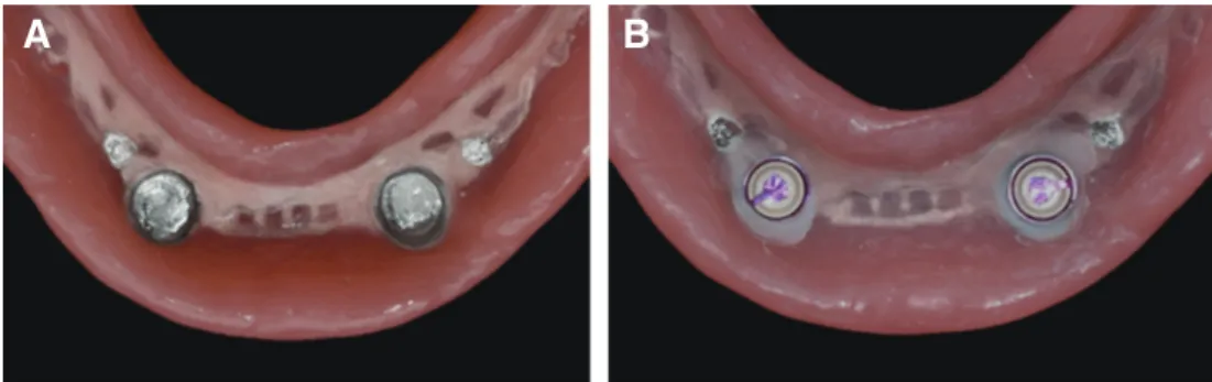 Fig. 16. Clinical remounting. (A) Right side view, (B) Frontal view, (C) Left side view.