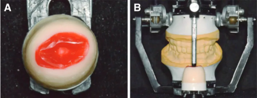 Fig. 14. Aesthetic improvement according to occlusal vertical di- di-mension elevation