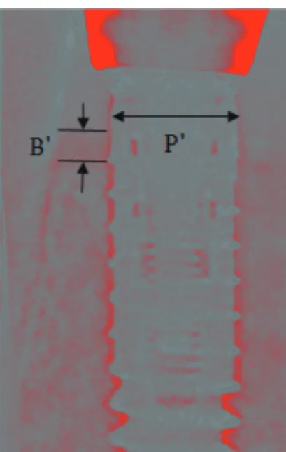 Table 2. Marginal bone resorption around immediate loading implants  according to implant connection type