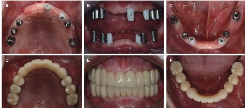 Fig. 7. Analysis of smile line.