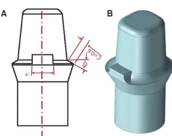 Fig. 2. Illustration of cementation gap setting, using Ceramill mind software.