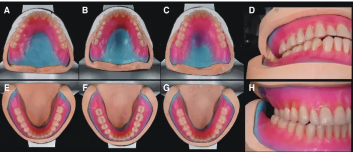 Table 1. Masticatory test result