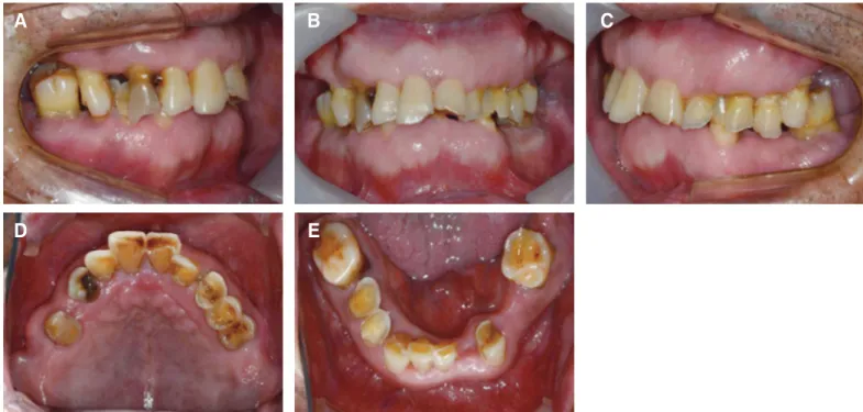 Fig. 2. Initial panoramic radiograph.