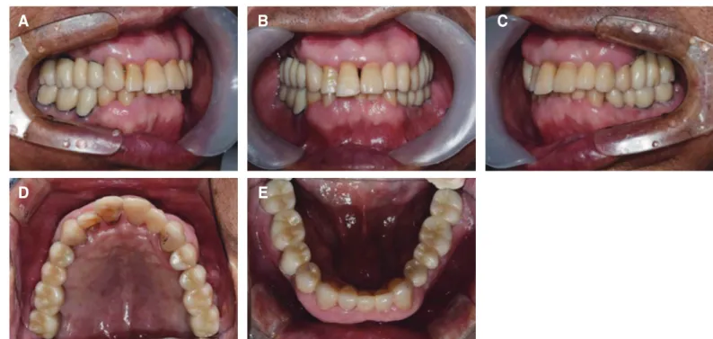 Fig. 5. Panoramic radiograph after treatment.