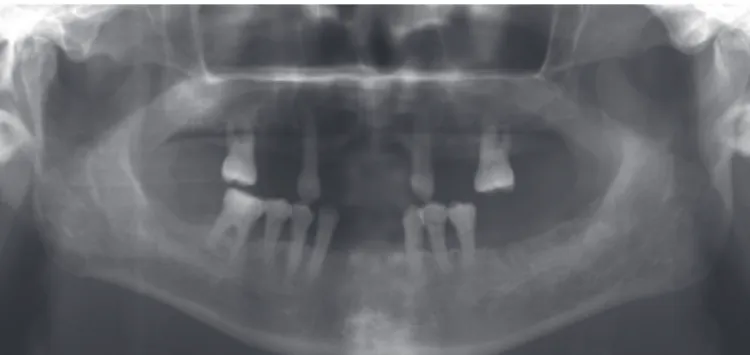 Fig. 1. Panoramic radiograph.