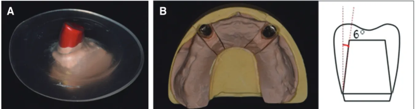 Fig. 11. Fabrication of inner crown. (A) Plastic cap for inner crown, (B) 6 degree conical crown.