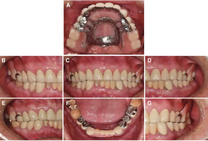 Fig. 11. Panoramic radiograph after treatment.
