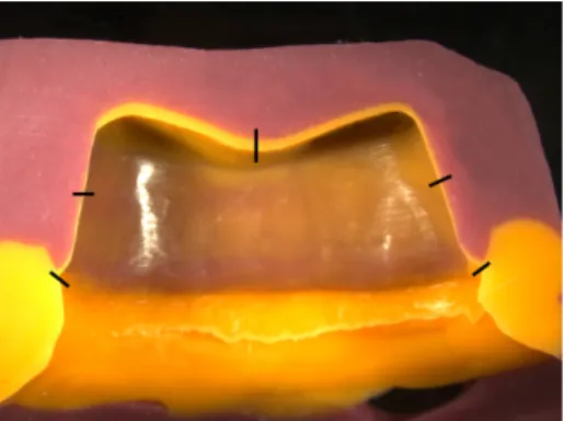Fig. 7. Stabilized replica after segmentation in the bucco-palatal direction.