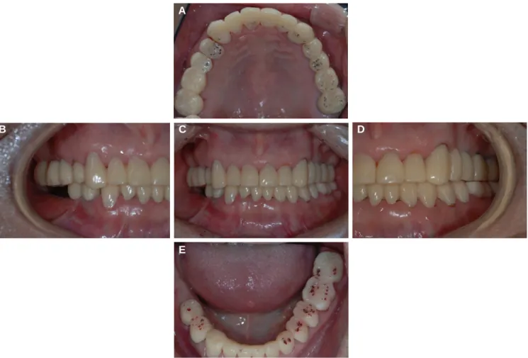 Table 1. System and size of dental implants used in this case