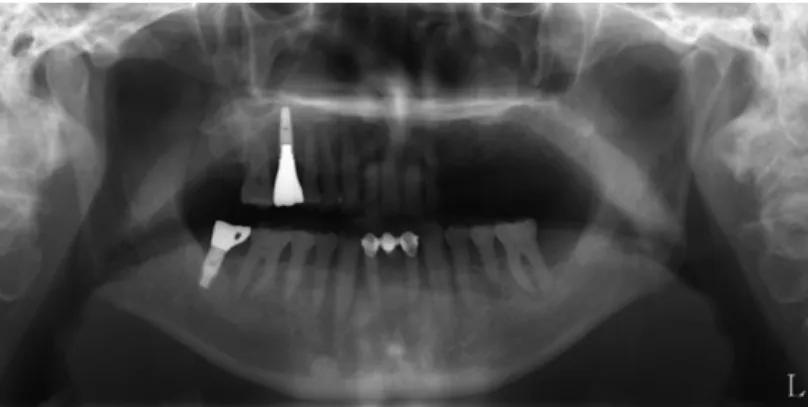 Fig. 2. Preoperative panoramic radiograph.