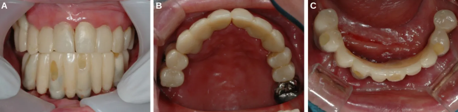Fig. 3. Panoramic radiograph after implant surgery.