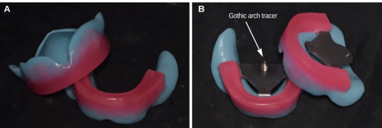 Fig. 4. At the second visit of patient. (A) Border molding, (B) Final impression, (C) Jaw relation record using impression occlusal rim (IOR).