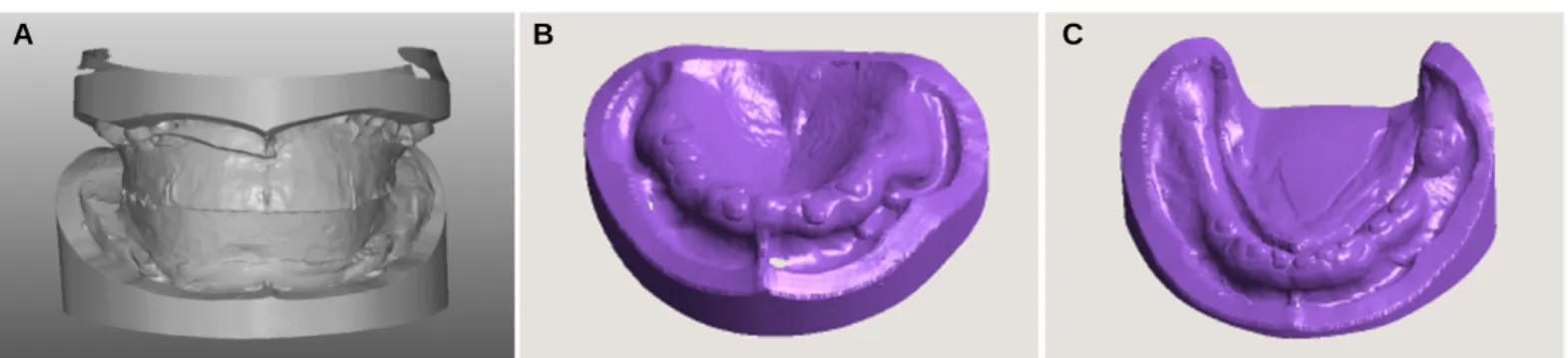 Fig. 6. Stereolithography (STL) record. (A) Impression occlusal rim (IOR) with cast, (B) Maxilla cast, (C) Mandible cast.
