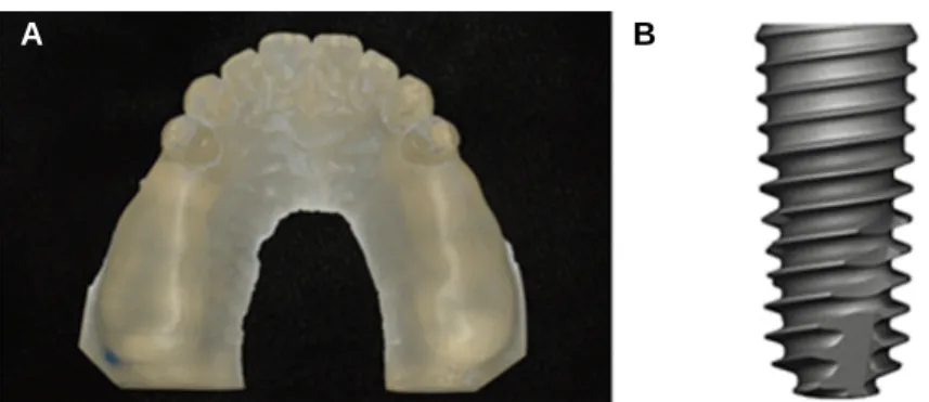 Fig. 1. Resin model and implant uesd in this study. (A) Resin model made by VisiJet M3 Stoneplast (3DSYSTEMS), (B) TS III SA (Osstem