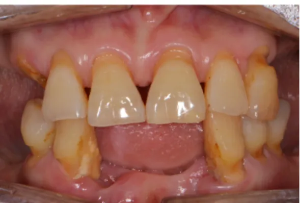 Fig. 1. Initial intra-oral view. Fig. 2. Initial panoramic radiograph.
