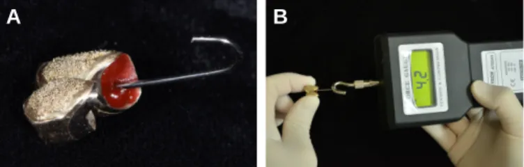 Fig. 6. Jaw relation record with interim prostheses using pattern resin.