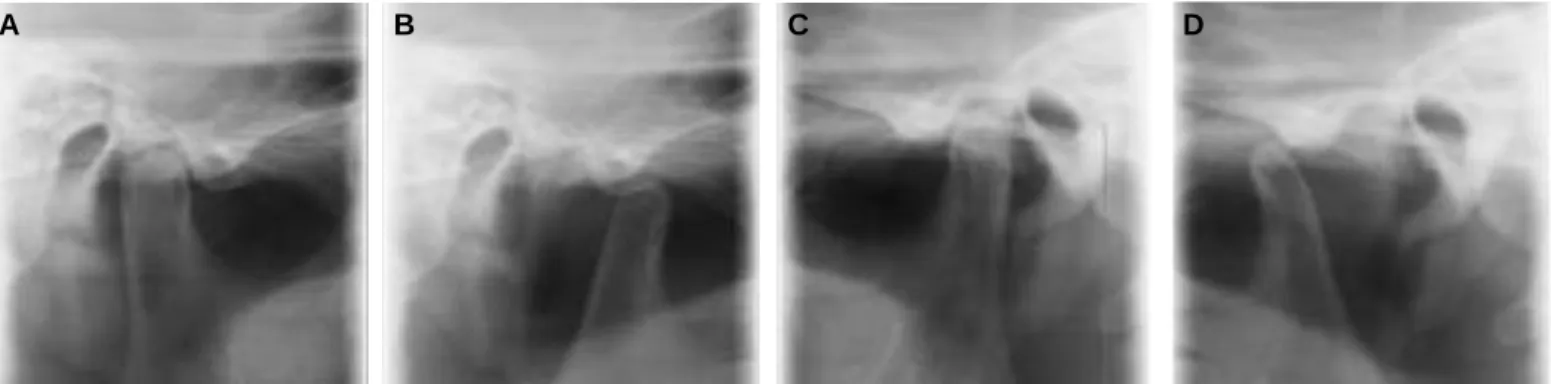 Fig. 4. Diagnostic waxup model.
