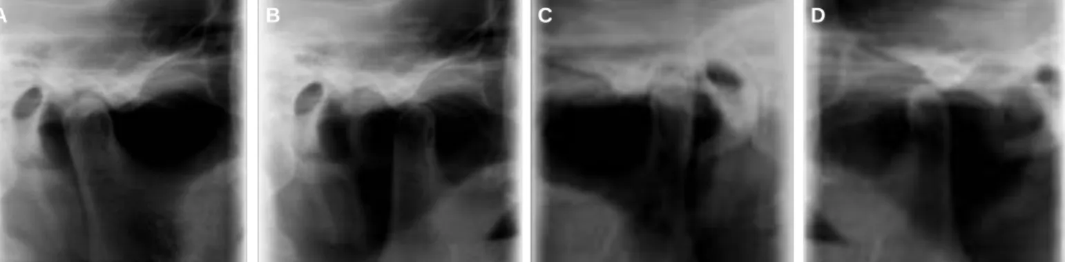 Fig. 9. Panoramic radiograph after treatment.