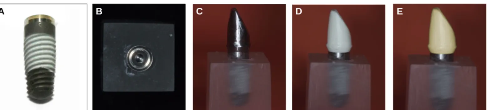 Fig. 2. Cross-sectional view of abutment-implant assemblies. (A) Titanium abutment, (B) Prefabricated zirconia abutment, (C) Customized zirconia abutment 