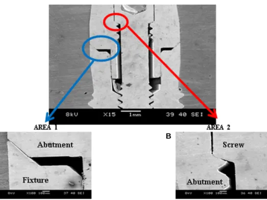 Fig. 4. Schematic drawing of the measuring points in abutment-implant interface. Fig. 5