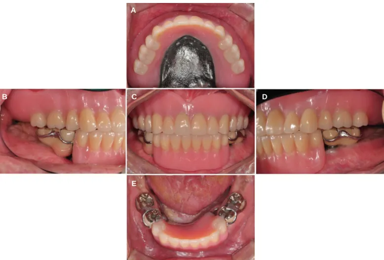 Fig. 7. Extraoral photograph (A) Before treatment, (B) After treatment.
