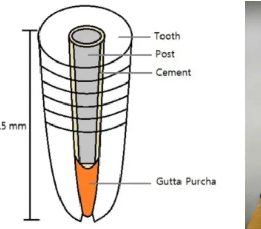 Fig. 1. Schematic view of tooth sample. Fig. 2. Push-out test. Fig. 3. Schematic view of push-out test.