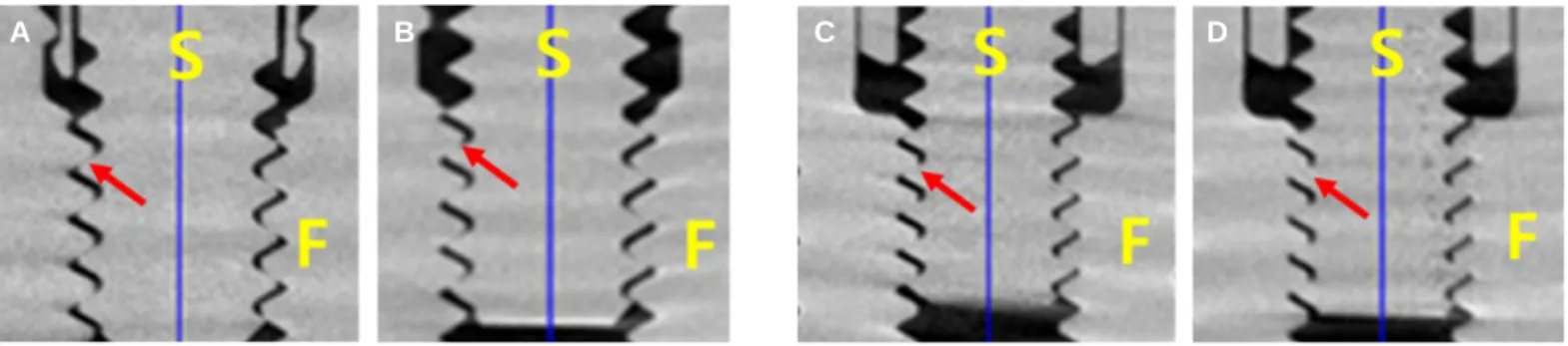 Fig. 4. Sagittal/coronal section in each Group. (A) Group 1, (B) Group 2, (C) Group 3, (D) Group 4, Group 1 and Group 2: 3i system, Group 3 and Group 4: Astra  sys-tem.
