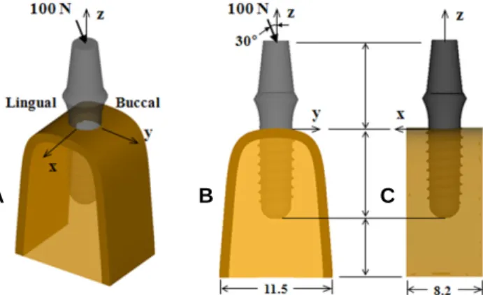 Fig. 1. Dimensions of a cylinder shaped implant body and the four different threads incorporated into the implant: (A) buttress, (B) V-shaped, (C) reverse buttress, and (D) square shaped threads (unit: mm)