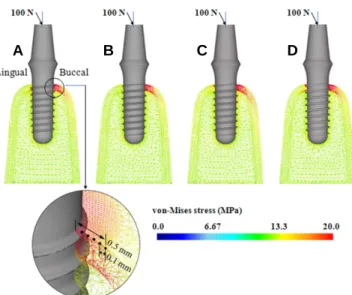 Fig. 4. The von Mises stresses in bone around the implants with (A) buttress, (B) V-shape, (C) reverse buttress and (D) square threads