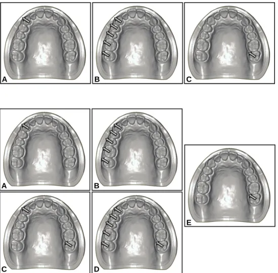 Fig. 2. Classification of occlusal contact patterns in the system 1 (considering occlusal contact  pat-terns on working side only)