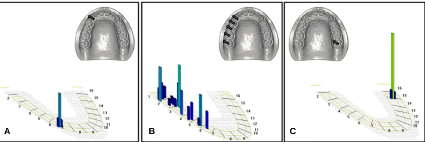 Fig. 4. Result of T-Scan analysis in the system 1. (A) Canine protection, (B) Group function, (C) Unclassifiable pattern.