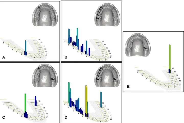 Fig. 7. Result of T-Scan analysis in the system 2. (A) Canine protection (without nonworking side contacts), (B) Group function (without nonworking side contacts), (C, D) With working &amp; nonworking side occlusal contacts, (E) Unclassifiable pattern.