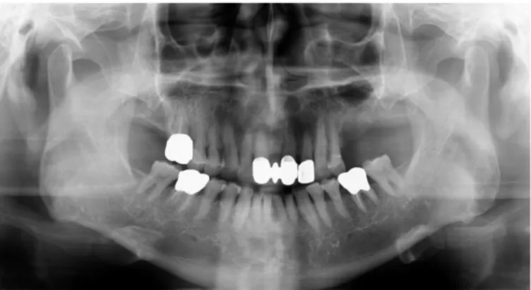 Fig. 1. Panoramic radiograph on first visit.