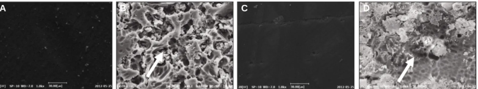 Fig. 4. Scanning electron microscopic view of 4 treated feldspathic porcelain surface (×1,000)