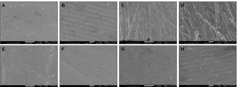 Fig. 4. SEM images of titanium group. (A),(B) no treatment (Control), (C),(D) Stainless steel scaler tip group (Group SS), (E),(F) Plastic hand curette group (Group PS), (G),(H) Copper alloy scaler tip group (Group IS)
