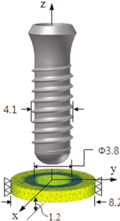 Table 1. Elasto-plastic material properties of human cortical bone taken from literature 28