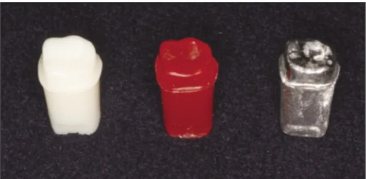 Fig. 2. Full zirconia crown.