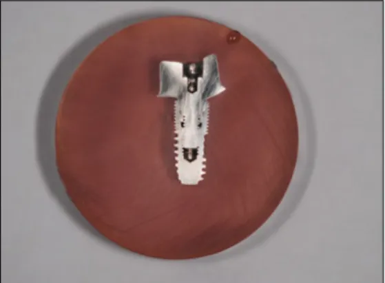 Table 1. Types of implant system, abutments, screws and torque value used in this study (n = 15)