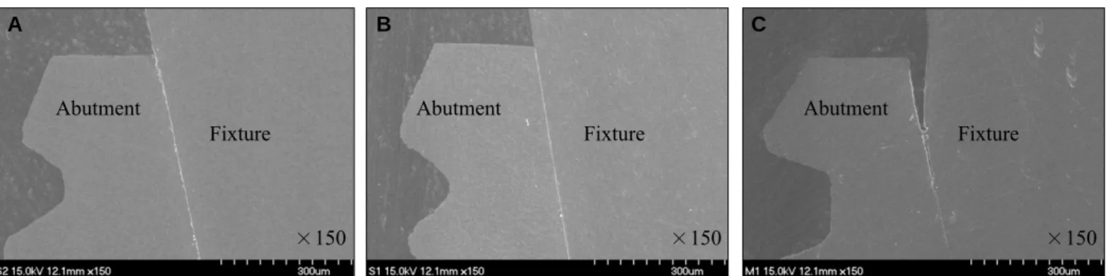 Fig. 7. FE-SEM ( ×150) images of abutment-screw interface in each group. A: Ready-made abutment (Transfer abutment), B: CAD-CAM custom-made abutment (CustomFit abutment), C