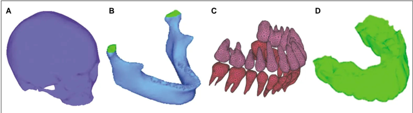 Fig. 1. Finite element model. A: Skull &amp; Maxillae, B: Mandible, C: Teeth, D: Mouthguard.