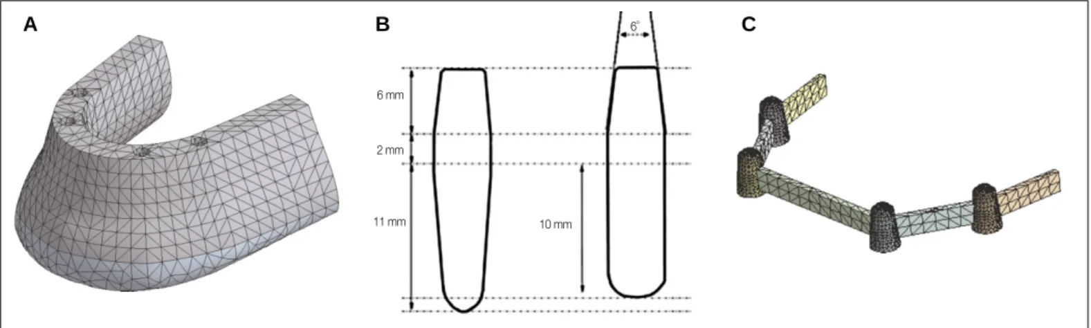 Fig. 1. Finite element model of A: mandible, B: natural tooth (left), implant (right), and abutments, C: outer crown and connector.