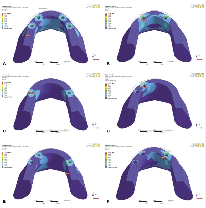 Table 3. Maximum von Mises stress values in mandible (MPa) 