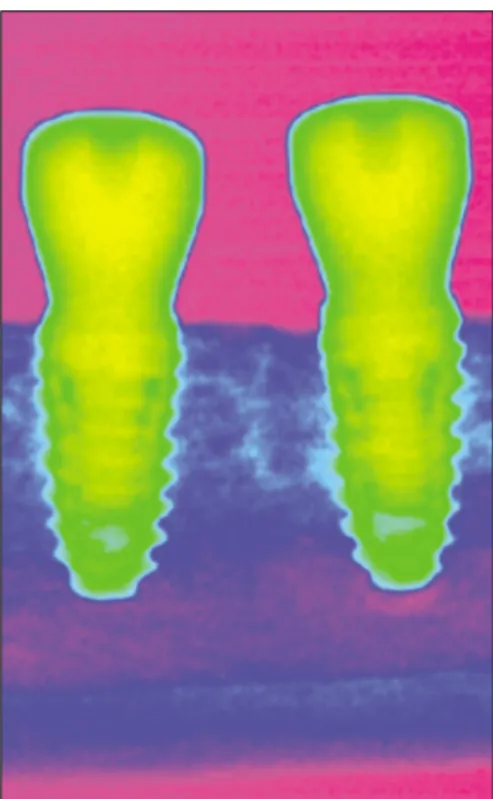 Fig. 3. Gray scale color coding for radiographic analysis.