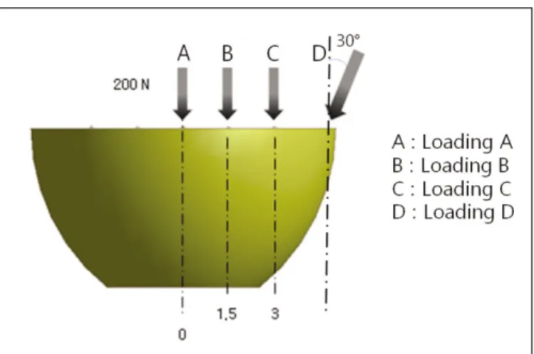 Fig. 3. Loading conditions. A: Loading A condition, B: Loading B condition, C: Loading C condition, D: Loading D condition
