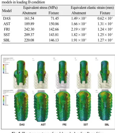 Table 4. Maximum equivalent stress and maximum equivalent strain of various models in loading B condition